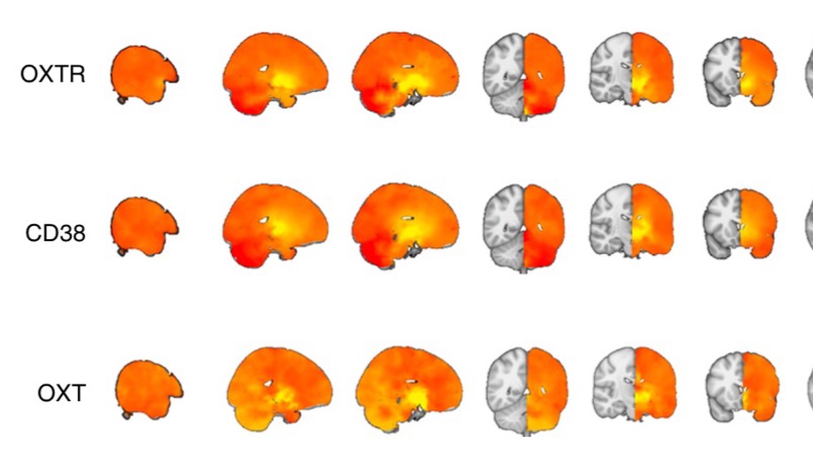 Oxytocin pathway gene networks in the human brain